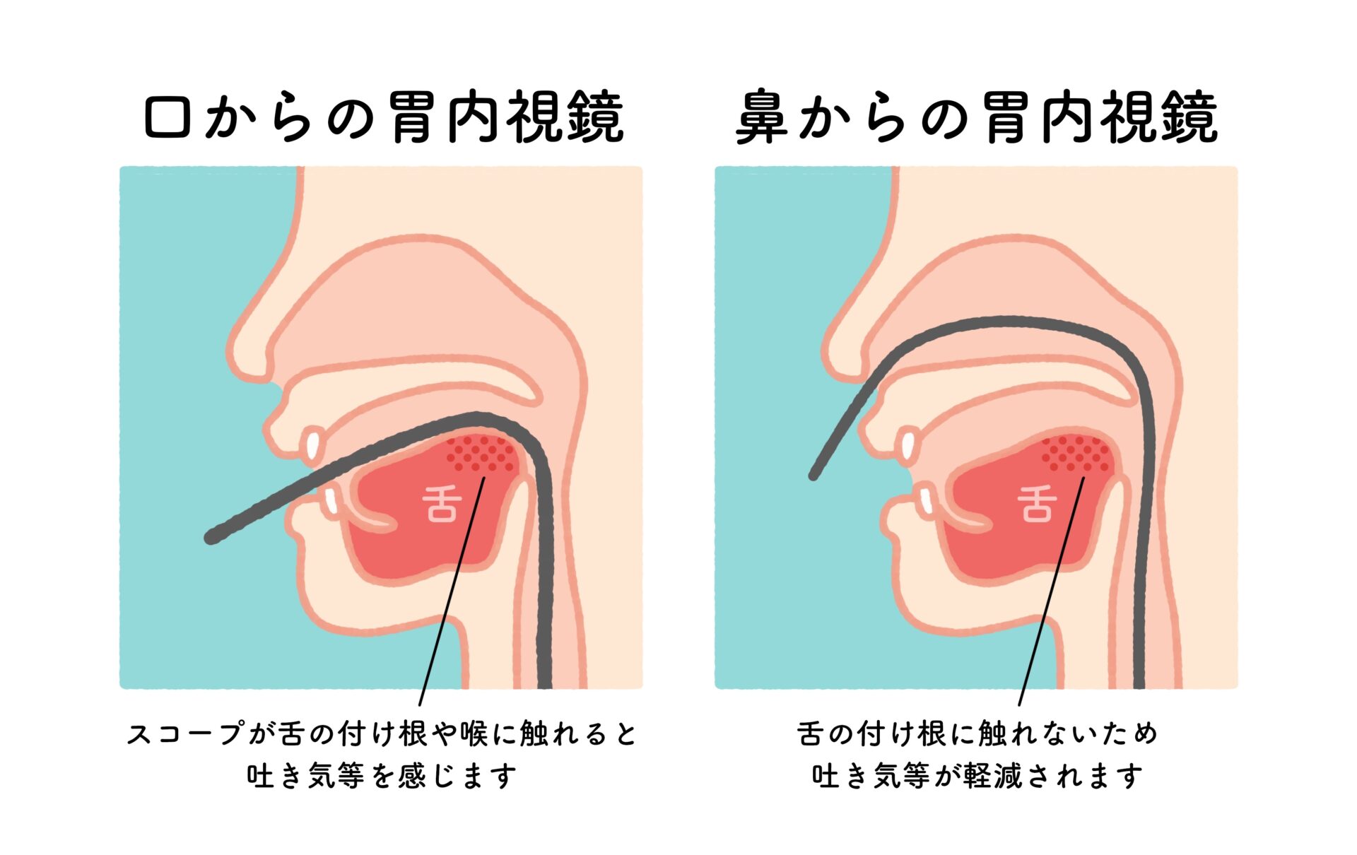 カメラ 販売 検査