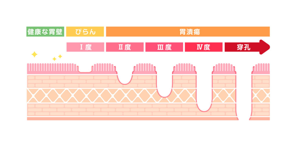 【イラスト】胃壁の断面図イラスト